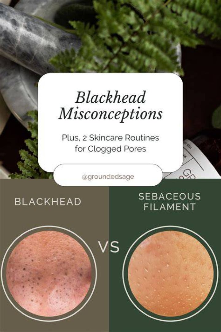 Are blackheads natural?