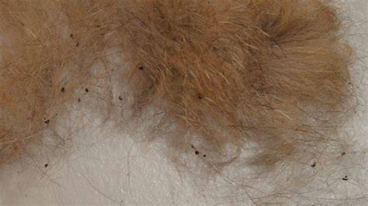 Are flea eggs black?