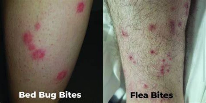 Can fleas come back after treatment?