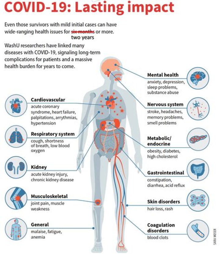 Can mild cases of COVID-19 cause long COVID-19?