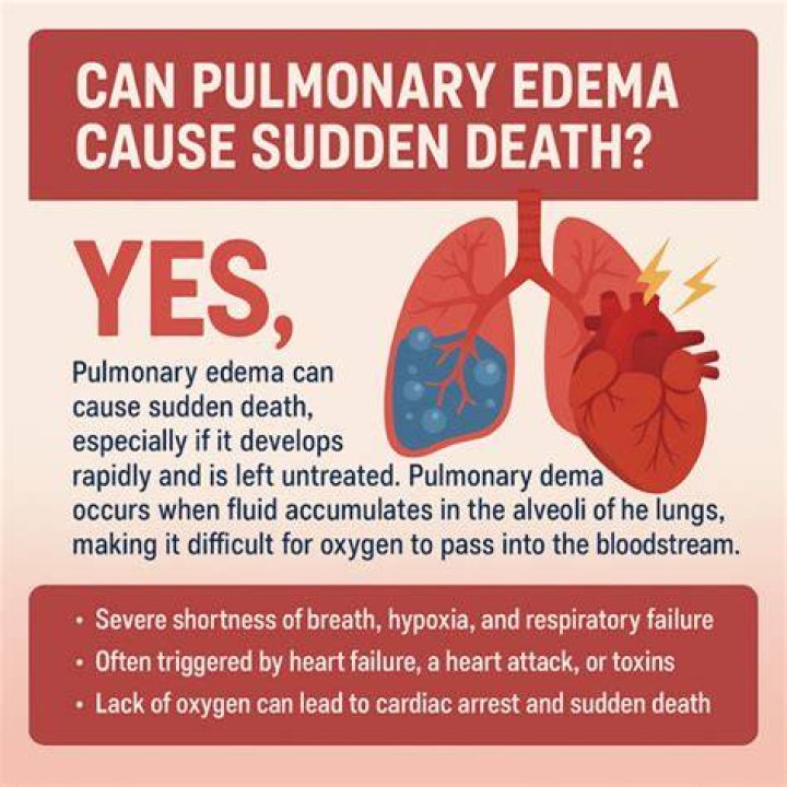 Can PVC cause sudden death?