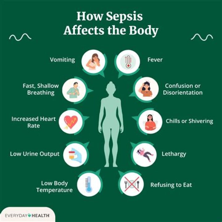 Can you get sepsis from a boil?