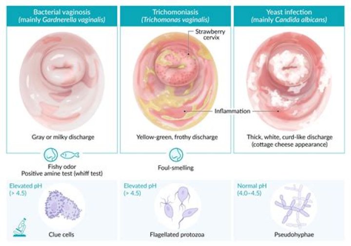 Can you get trich from poor hygiene?