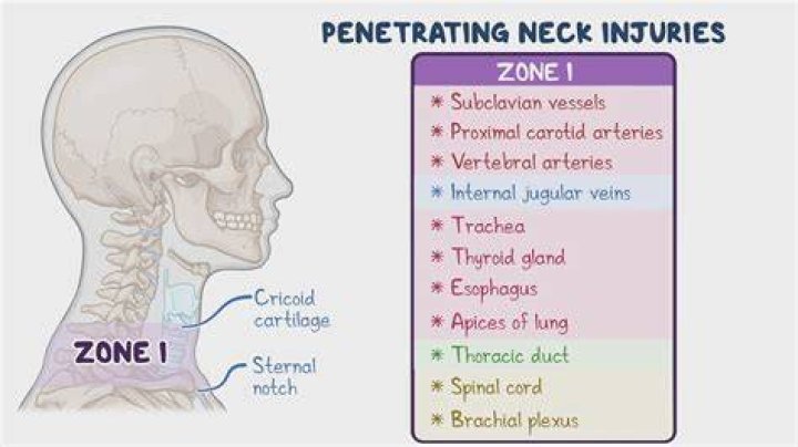 Do rats go for your neck when cornered?