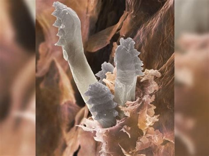 Do skin mites live in your pores?