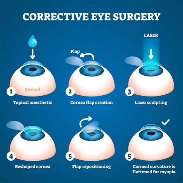 Does eye surgery hurt?