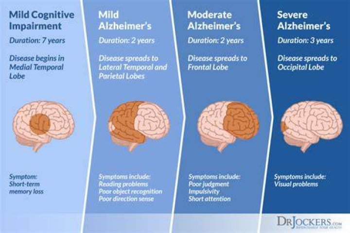 How do Alzheimers start?