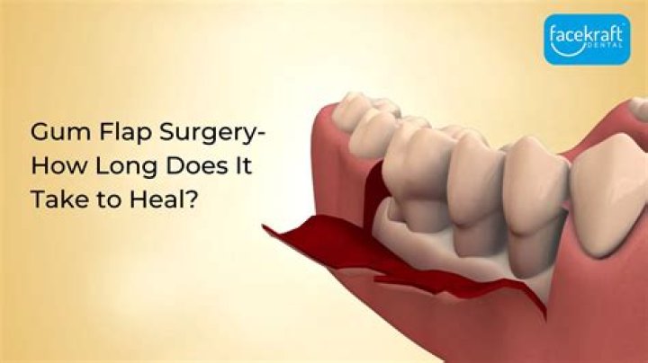 How long does gum surgery pain last?