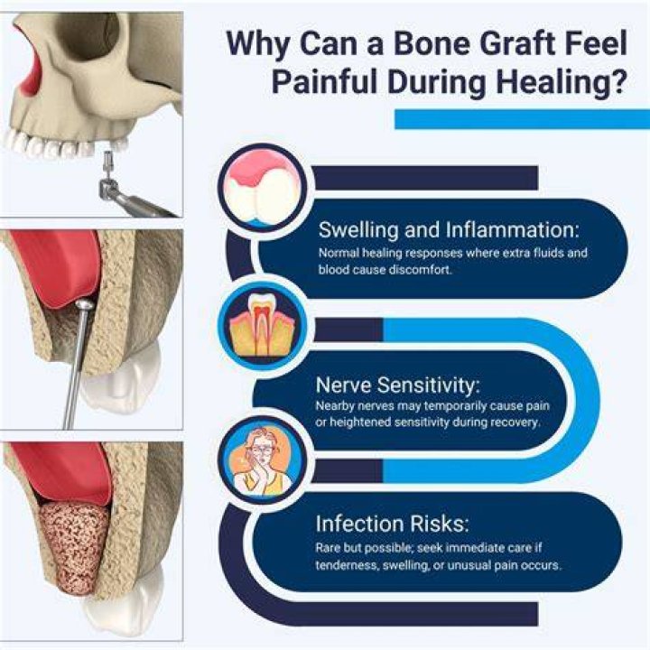 How long should a dental bone graft hurt?