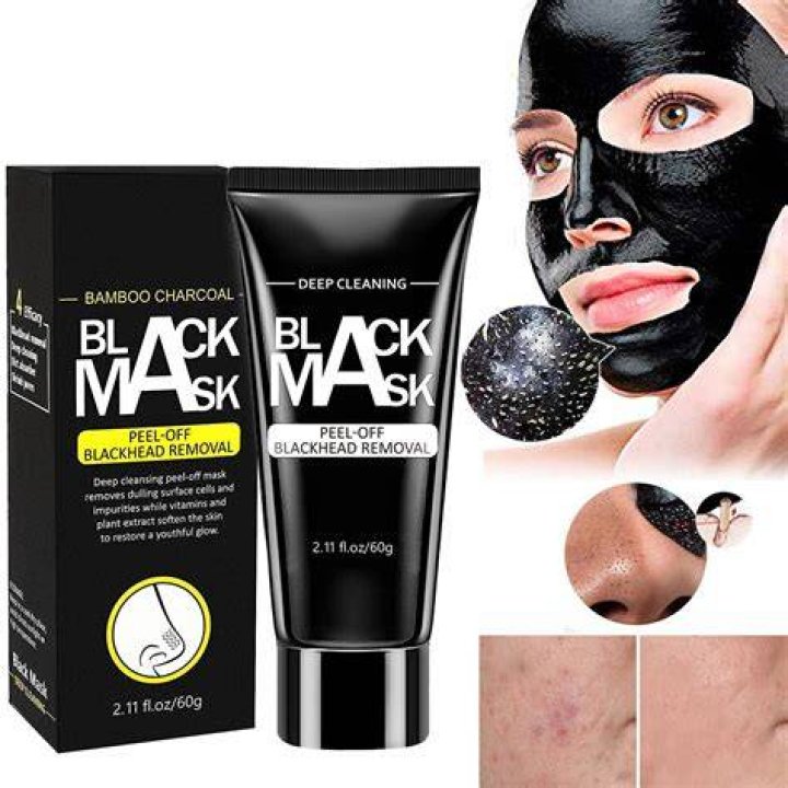 Is charcoal mask remove blackheads?