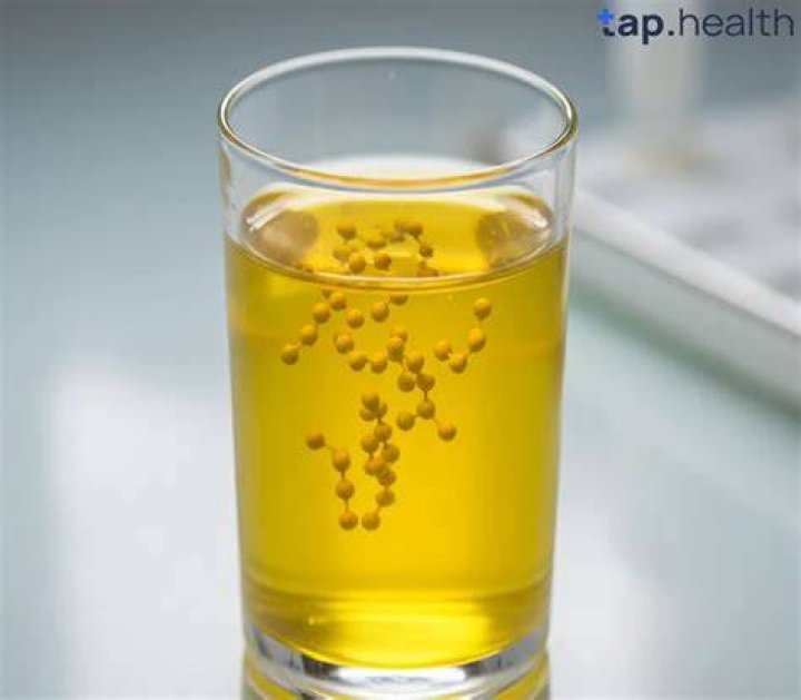 Should I stop taking vitamin B if urine is yellow?