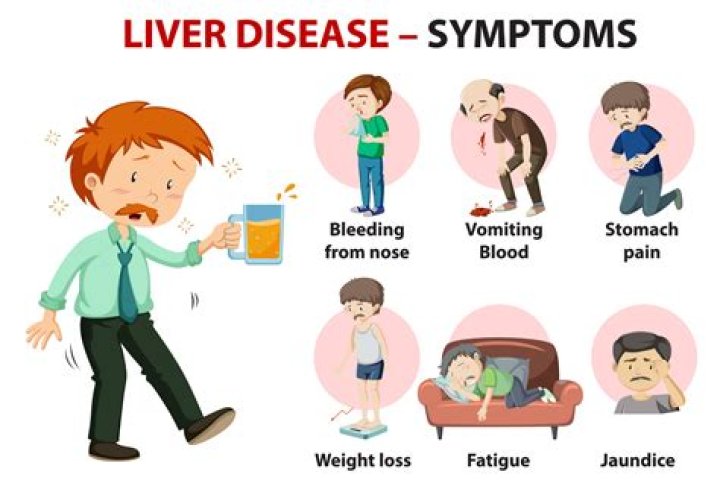 What does liver disease stool look like?
