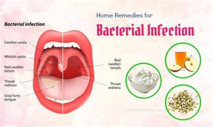 What kills infection in mouth?