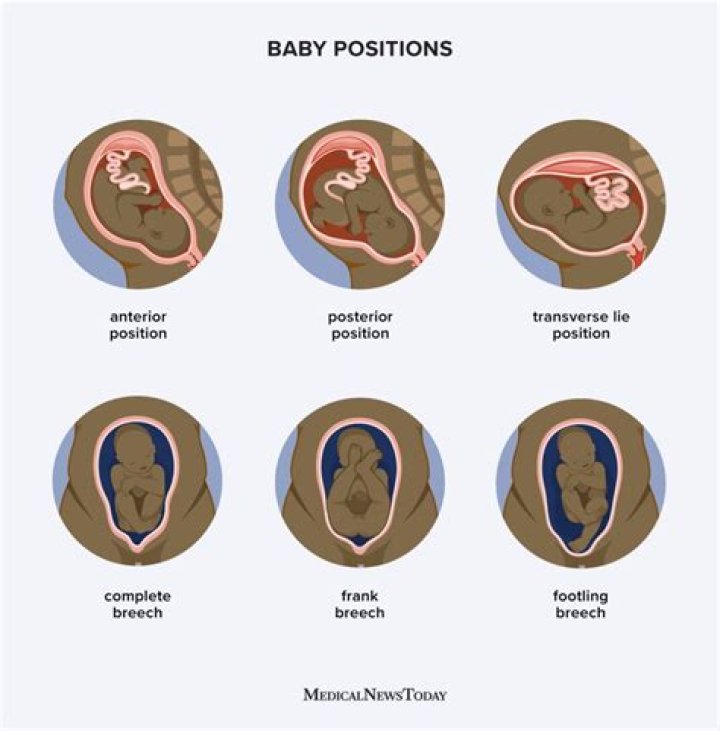 Which side is the baby located in the stomach?