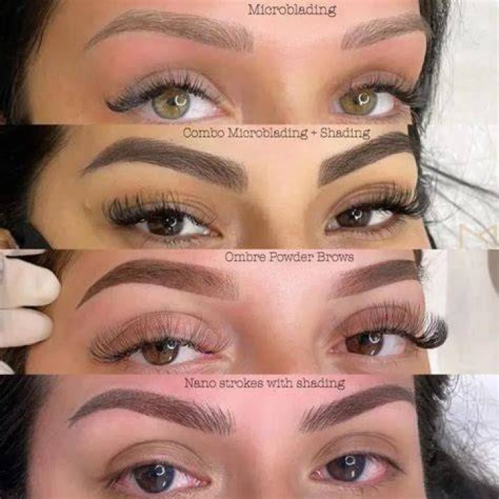 Why do people get Microshading?
